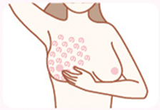 乳房按摩